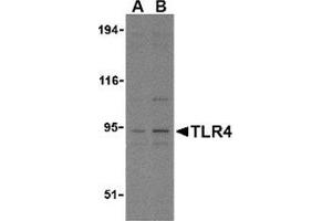 Western blot analysis of TLR4 in PC-3 cell lysates with this product at (A) 2. (TLR4 anticorps  (N-Term))
