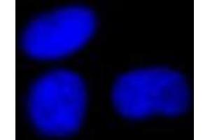 Immunofluorescence (IF) image for anti-SWI/SNF Related, Matrix Associated, Actin Dependent Regulator of Chromatin, Subfamily A, Member 4 (SMARCA4) (C-Term) antibody (ABIN2451926)