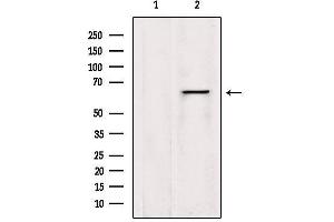 Western blot analysis of extracts from HepG2, using LGTN Antibody. (EIF2D anticorps  (Internal Region))