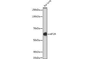 Western blot analysis of extracts of Rat lung, using eIF2A Rabbit mAb (ABIN7267035) at 1:1000 dilution.