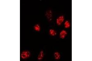 Immunofluorescent analysis of PPP3CA staining in Hela cells. (PPP3CA anticorps)