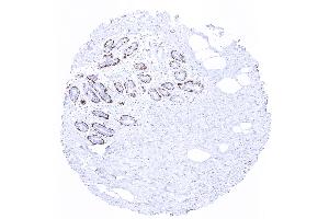 breast (Recombinant CNN1 anticorps  (C-Term))