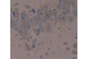 IHC-P analysis of Rat Tissue, with DAB staining. (DPP4 anticorps  (AA 638-767))