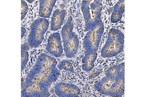 IHC analysis of MUC1 using anti-MUC1 antibody (ABIN7599704).