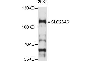 Western blot analysis of extracts of 293T cells, using SLC26A6 antibody (ABIN4905190) at 1:1000 dilution. (SLC26A6 anticorps)
