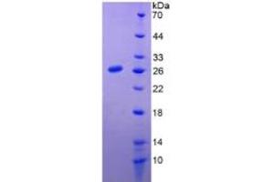 SDS-PAGE of Protein Standard from the Kit  (Highly purified E. (Prolactin Kit ELISA)