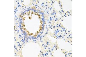 Immunohistochemistry of paraffin-embedded rat lung using NCR3 antibody (ABIN5974302) at dilution of 1/100 (40x lens). (NCR3 anticorps)