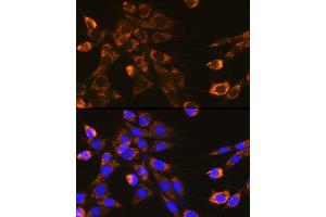 Immunofluorescence analysis of NIH-3T3 cells using Integrin-β1/CD29 Rabbit pAb (ABIN6134032, ABIN6142578, ABIN6142579 and ABIN6219452) at dilution of 1:100 (40x lens). (ITGB1 anticorps  (AA 600-700))