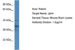 Host: Rabbit Target Name: Jph4 Sample Type: Mouse Brain lysates Antibody Dilution: 1. (Junctophilin 4 anticorps  (Middle Region))
