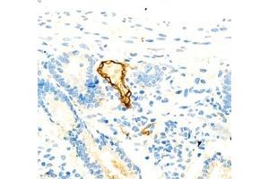 Immunohistochemistry of paraffin embedded rat colon using MADCAM1 (ABIN7074695) at dilution of 1:1800 (400x lens) (MADCAM1 anticorps)
