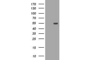 Image no. 1 for anti-Golgin, RAB6-Interacting (GORAB) (AA 35-394) antibody (ABIN1491443)