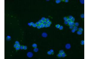 Image no. 1 for anti-Neural Cell Adhesion Molecule 1 (NCAM1) antibody (ABIN335373)