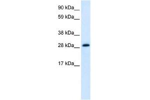 Human heart; WB Suggested Anti-ABT1 Antibody Titration: 1. (Activator of Basal Transcription 1 anticorps  (Middle Region))