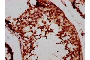 IHC image of ABIN7152883 diluted at 1:500 and staining in paraffin-embedded human testis tissue performed on a Leica BondTM system. (FSD1 anticorps  (AA 251-370))