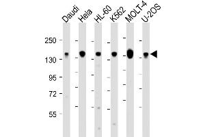 Western Blot at 1:2000 dilution Lane 1: Daudi whole cell lysate Lane 2: Hela whole cell lysate Lane 3: HL-60 whole cell lysate Lane 4: K562 whole cell lysate Lane 5: MOLT-4 whole cell lysate Lane 6: U-2OS whole cell lysate Lysates/proteins at 20 ug per lane.