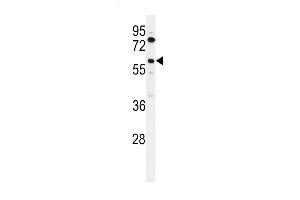 Western blot analysis of ACBG2 Antibody (Center) (ABIN653811 and ABIN2843086) in K562 cell line lysates (35 μg/lane).