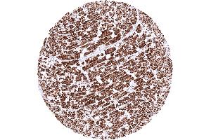 Heart muscle exhibiting a strong granular cytoplasmic SDHA staining (Recombinant SDHA anticorps  (N-Term))