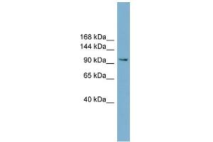 WB Suggested Anti-NCAM2 Antibody Titration:  0. (NCAM2 anticorps  (Middle Region))