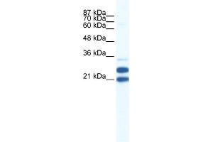 WB Suggested Anti-TRIM34 Antibody Titration:  0.