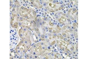 Immunohistochemistry of paraffin-embedded Rat kidney using ACO1 Polyclonal Antibody at dilution of 1:100 (40x lens). (Aconitase 1 anticorps)