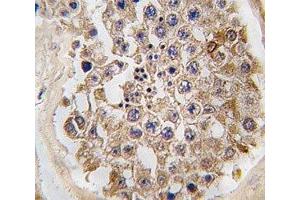 IHC analysis of FFPE human testis tissue stained with mTOR antibody (MTOR anticorps  (AA 2459-2488))