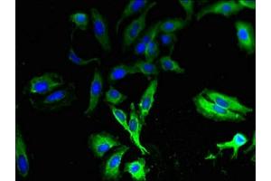 Immunofluorescent analysis of Hela cells using ABIN7171536 at dilution of 1:100 and Alexa Fluor 488-congugated AffiniPure Goat Anti-Rabbit IgG(H+L) (TAS2R13 anticorps  (AA 150-184))