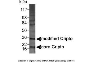 Image no. 1 for anti-Teratocarcinoma-Derived Growth Factor 1 (TDGF1) (N-Term) antibody (ABIN363493)