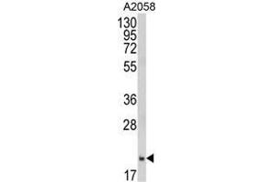 Western blot analysis of FTH1 Antibody (C-term) in A2058 cell line lysates (35 µg/lane). (FTH1 anticorps  (C-Term, Heavy Chain))