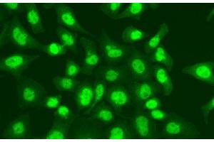 Immunofluorescence analysis of A549 cells using LIG1 Polyclonal Antibody (LIG1 anticorps)