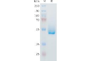 Mouse IL6 Protein, hFc Tag on SDS-PAGE under reducing condition.