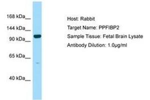 Image no. 1 for anti-Liprin-beta-2 (PPFIBP2) (AA 760-809) antibody (ABIN6750129) (PPFIBP2 anticorps  (AA 760-809))
