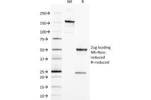 SDS-PAGE Analysis Purified EpCAM Mouse Monoclonal Antibody (EGP40/1373). (EpCAM anticorps  (Extracellular Domain))