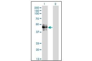 Western Blotting (WB) image for anti-CD177 Molecule (CD177) antibody (ABIN781918)
