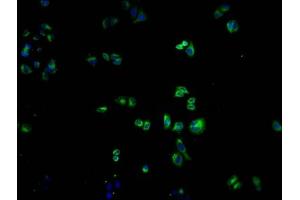 Immunofluorescence staining of Hela cells with ABIN7139968 at 1:100, counter-stained with DAPI.