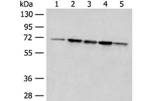 Western blot analysis of 293T cell Rat liver tissue A172 and Jurkat cell lysates using ACSF2 Polyclonal Antibody at dilution of 1:400 (ACSF2 anticorps)