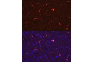 Immunofluorescence analysis of rat brain cells using /IB Rabbit pAb (2391) at dilution of 1:50 (40x lens). (Iba1 anticorps  (AA 1-147))