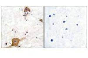 Immunohistochemical analysis of paraffin-embedded human brain tissue using NRG1 isoform-10 antibody.