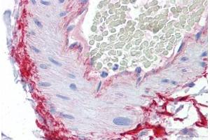 Human Vessel: Formalin-Fixed, Paraffin-Embedded (FFPE) (ROCK2 anticorps  (AA 1279-1389))