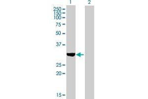 Western Blot analysis of SULT1C2 expression in transfected 293T cell line by SULT1C2 MaxPab polyclonal antibody. (SULT1C2 anticorps  (AA 1-296))