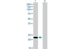Western Blot analysis of FUSIP1 expression in transfected 293T cell line by FUSIP1 monoclonal antibody (M03), clone 1A6. (SRSF10 anticorps  (AA 1-100))