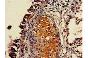 Immunohistochemistry of paraffin-embedded human lung tissue using ABIN7162445 at dilution of 1:100 (P2RX4 anticorps  (AA 91-176))