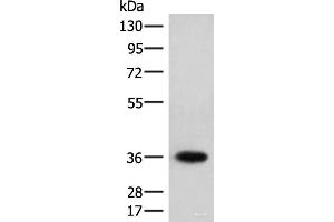 Western blot analysis of Jurkat cell lysate using HOXC12 Polyclonal Antibody at dilution of 1:500 (HOXC12 anticorps)