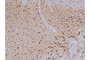 ABIN6267324 at 1/200 staining Rat brain tissue sections by IHC-P. (Tyrosine Hydroxylase anticorps  (pSer19))