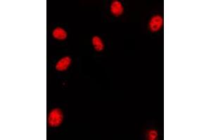 Immunofluorescent analysis of HOXA11/D11 staining in HeLa cells. (HOXA11/D11 anticorps  (C-Term))