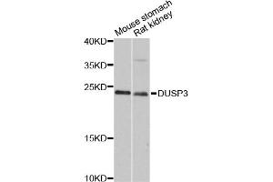 Western blot analysis of extracts of various cell lines, using DUSP3 antibody (ABIN6290308) at 1:3000 dilution. (Dual Specificity Phosphatase 3 (DUSP3) anticorps)