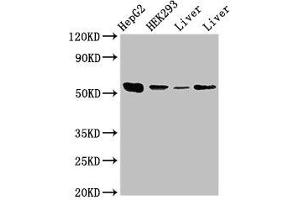 Western Blot Positive WB detected in: HepG2 whole cell lysate, HEK293 whole cell lysate, Rat liver tissue, Mouse liver tissue All lanes: MAP2K5 antibody at 3. (MAP2K5 anticorps  (AA 1-190))
