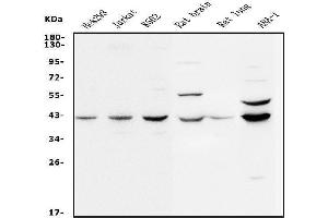 Western blot analysis of MEK2/MAP2K2 using anti-MEK2/MAP2K2 antibody (ABIN7599357).