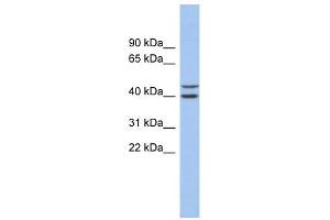 FBXL14 antibody used at 1 ug/ml to detect target protein. (FBXL14 anticorps  (N-Term))