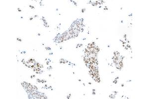 Immunocytochemistry (ICC) image for anti-Forkhead Box P1 (FOXP1) (AA 627-677) antibody (ABIN7454010)