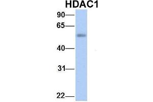 Host:  Rabbit  Target Name:  HDAC1  Sample Type:  Human Fetal Lung  Antibody Dilution:  1. (HDAC1 anticorps  (Middle Region))